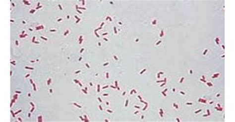 Microscopic observation of a specimen H. influenzae shows gram-negative ...