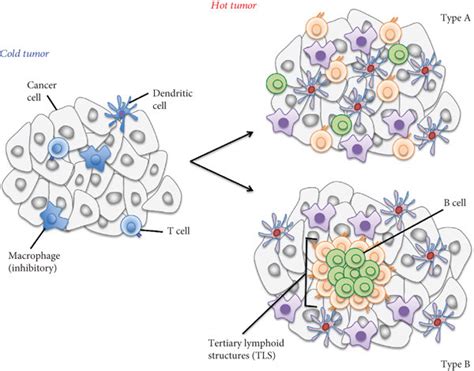 Classification Of Tumors By Immune Cell Infiltration Tumor Types Can Download Scientific