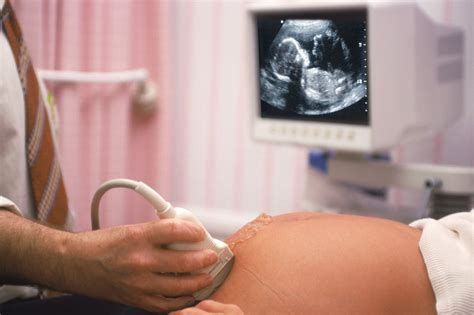 How Long Does An Anatomy Scan Ultrasound Take At Maria Landreth Blog