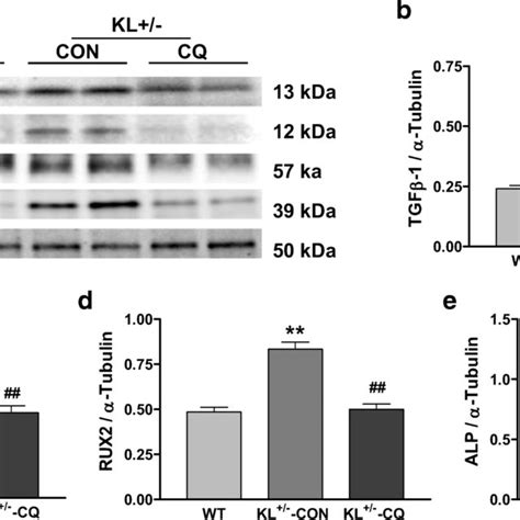 Inhibition Of Autophagy By Chloroquine Attenuated The Upregulation Of