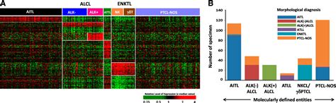 Table 1 From LYMPHOID NEOPLASIA Gene Expression Signatures Delineate