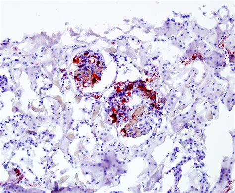 Pathology Outlines Oil Red O