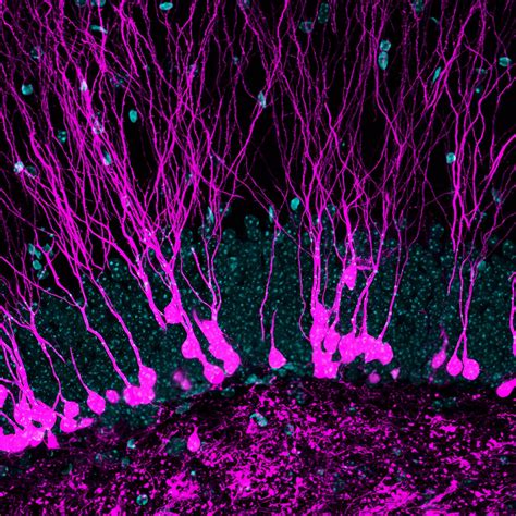 Un nuevo estudio sugiere que una fusión mitocondrial mejorada impulsa