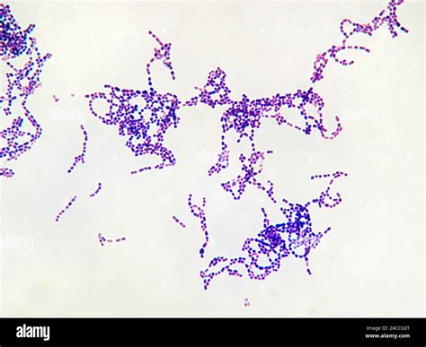 Streptococcus pyogenes bacteria, light micrograph. These are Gram ...