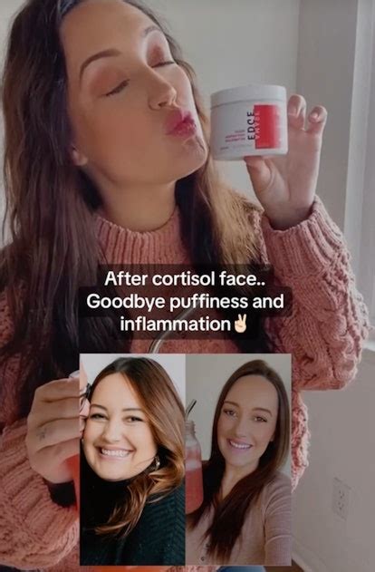 What Is Cortisol Face A Side Effect Caused By Stress