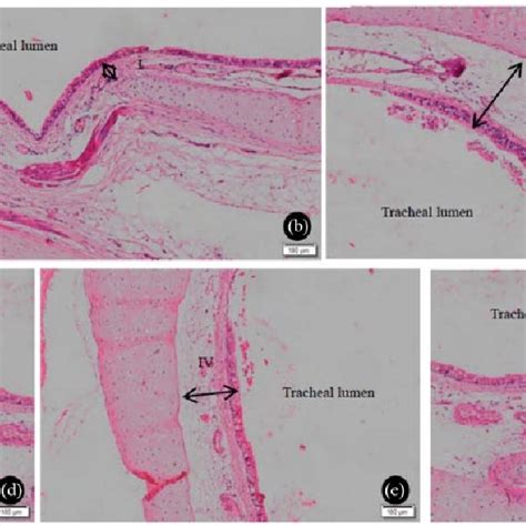 Tracheal Lamina Propria And Epithelium Of The Sham Operated Control