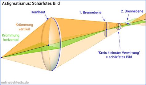 Astigmatismus Stabsichtigkeit