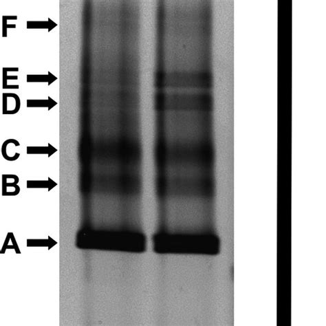 Denaturing Gradient Gel Electrophoresis Dgge Analyses Of The Gene