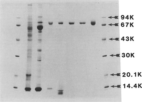 The Sds Polyacrylamide Gel Electrophoresis Of A Standard Protein