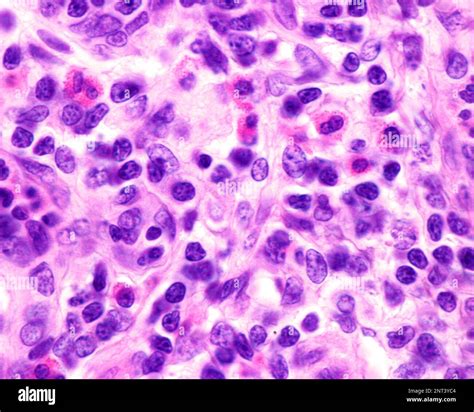 Micrograf A De Microscopio Ptico Que Muestra Granulocitos Eosin Filos