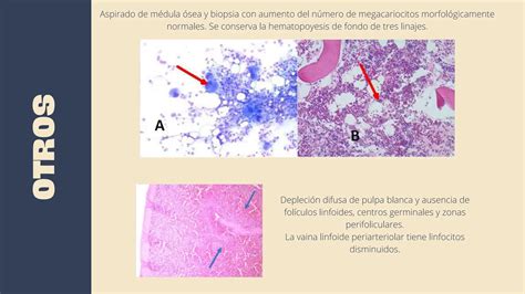 Alteración adquirida de la hemostasia primaria pptx