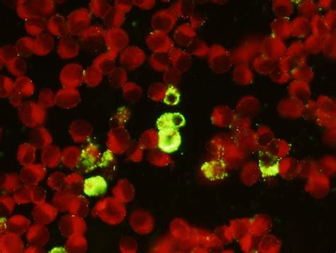 NEW Rickettsia ?Monoclonal Antibody