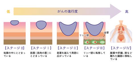 便潜血検査（大腸がん検診） 社会医療法人 明和会