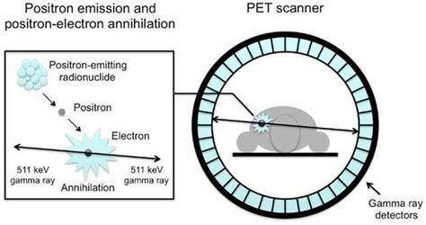 Learn the Basics of Positron Emission Tomography (PET)