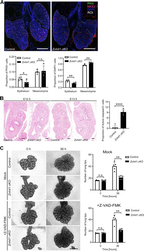 Chromatin remodeler Znhit1 controls bone morphogenetic protein ... 