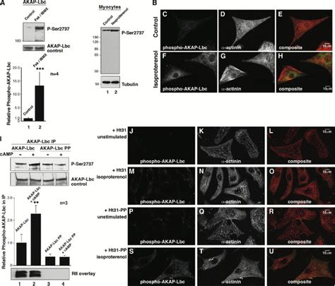 Akap Lbc Nucleates A Protein Kinase D Activation Scaffold Molecular Cell