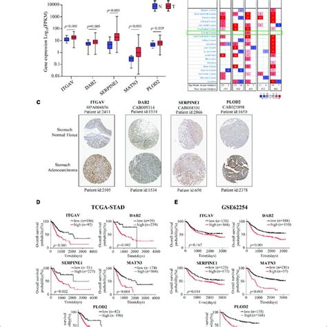 Expression Profiles Kaplan Meier Analyses Of EMT Related Signature