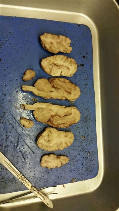 Sheep Brain Dissection Anatomy And Physiology