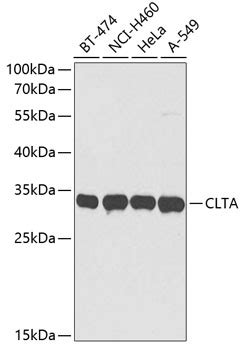 CLTA Polyclonal Antibody SAB Signalway Antibody