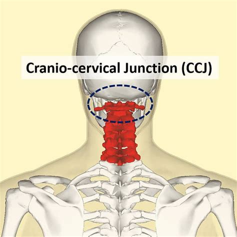 Cervical Vertebrae Wikipedia