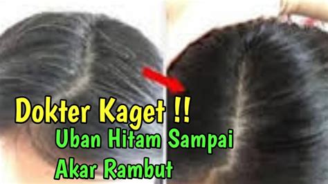 Uban Hilang Selamanya Tanpa Semir Rambut Bikin Orang Kaget Youtube