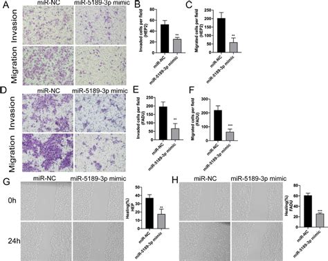 Up Regulation Of Mir P Inhibits Cell Invasion And Migration Of