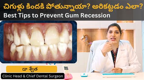 4 Ways to Safely Remove Food Stuck in Teeth పళల మధయ ఇరకకనన