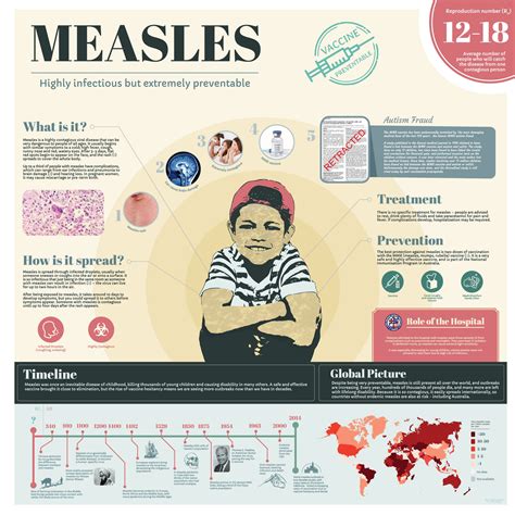 Infographic Measles