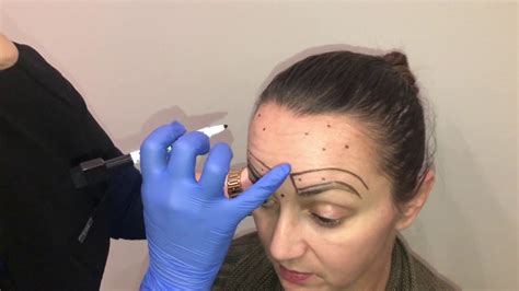 Botox Filler Certification Course