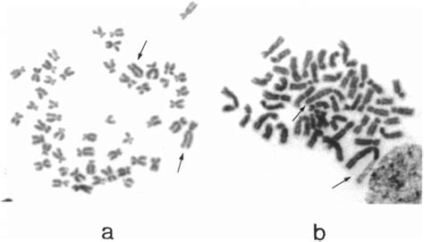 Metaphases From Conventional Giemsa Staining Of The Structural Changes