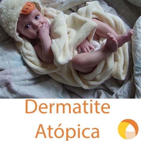 Dermatite Atópica Entenda o que é e como cuidar Alberto Jorge