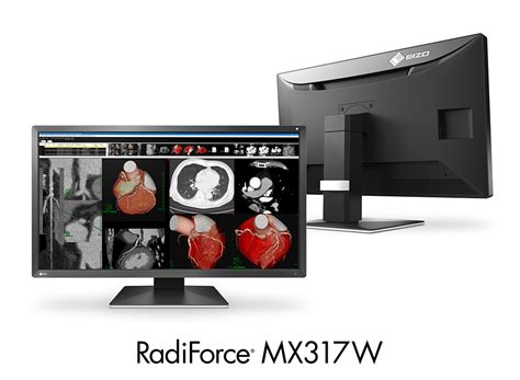 RadiForce MX317W EIZO