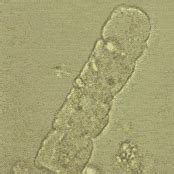 Examen Microscopico