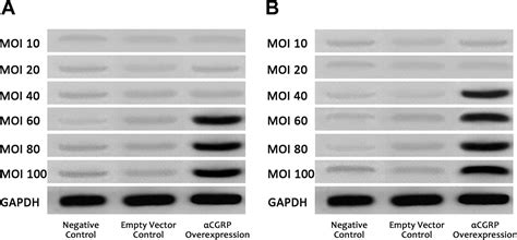 Cgrp Affects Bmscs Migration And Osteogenesis Via The Hippo Yap