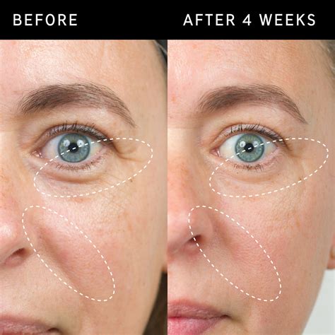 Ceramide Enriched Moisturizer To Restore And Hydrate Skin The Inkey
