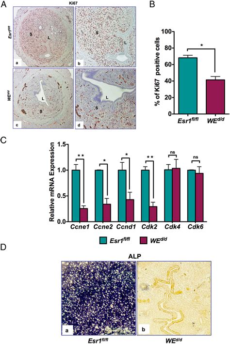 Uterine Stromal Cell Proliferation During Decidualization Is Impaired