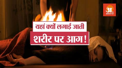 सुनिए मरीज के शरीर पर आग लगाने के पीछे की कहानी Weird Stories Podcast