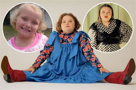 Honey Boo Boo Star Alana Thompson To Undergo Weight Loss Surgery