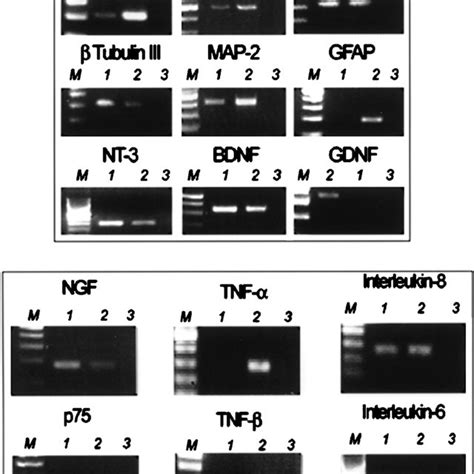 Neuroglial Characterization Of HMSCs In Vitro A RT PCR Expression Of