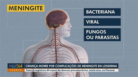 Crian A Morre Por Complica Es De Meningite Em Londrina Saiba Como