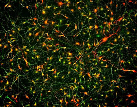 Brainxell Inc Terminally Differentiated Human Cortical Gabaergic