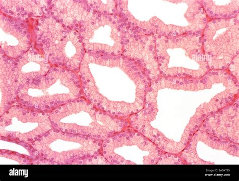 Lacrimal Gland Light Micrograph Of A Section Through A Lacrimal Gland