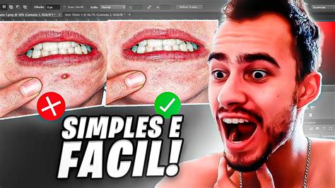 Como Tirar Espinha Do Rosto No Photoshop RÁpido E FÁcil Youtube