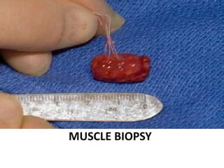 Muscle biopsy | PPT