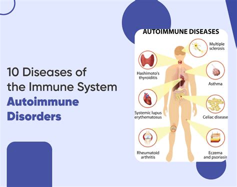 10 Diseases of the Immune System | Autoimmune Disorders