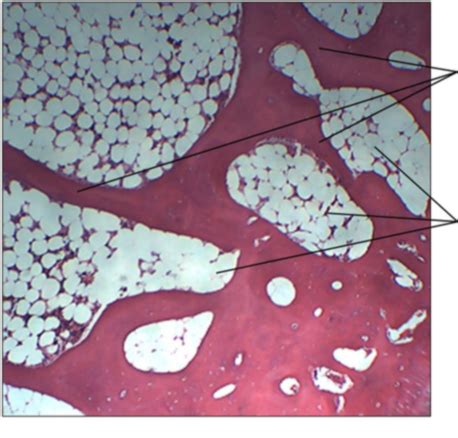 Spongy Cancellous Bone Connective Tissue X Diagram Quizlet