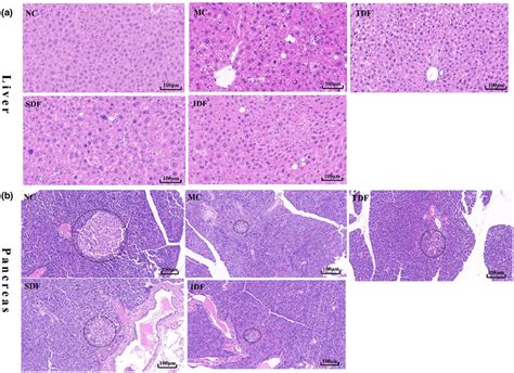 Effect Of BPDFs On The Liver And Pancreas Histopathology In T2DM Mice