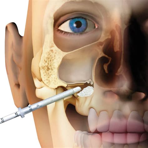 OsteoBiol