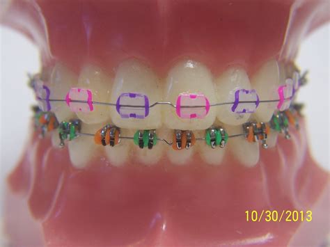 Orthodontics Color Wheel