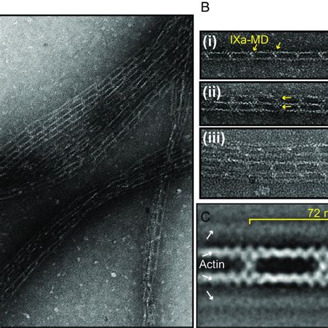 Negative Stain Em Revealed That Ixa Md Induced The Formation Of